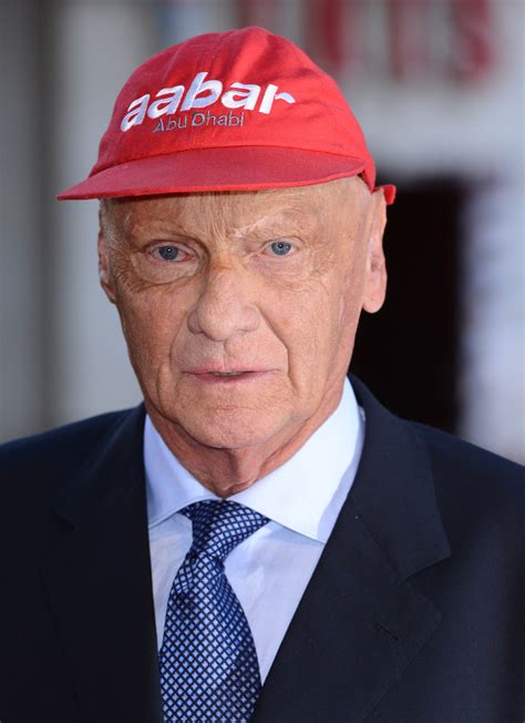 what happened to niki lauda face